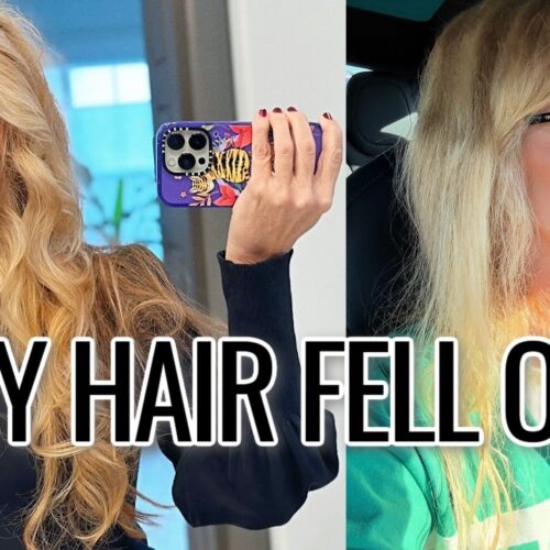 Female Hair Loss: Why My Hair Fell Out + What Helped 💔